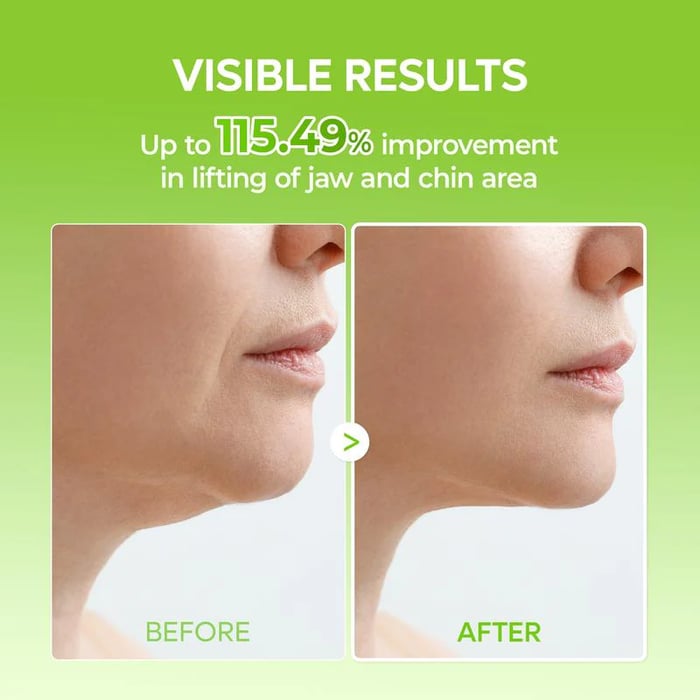 V-liftende mewingband (4 maskers per verpakking)
